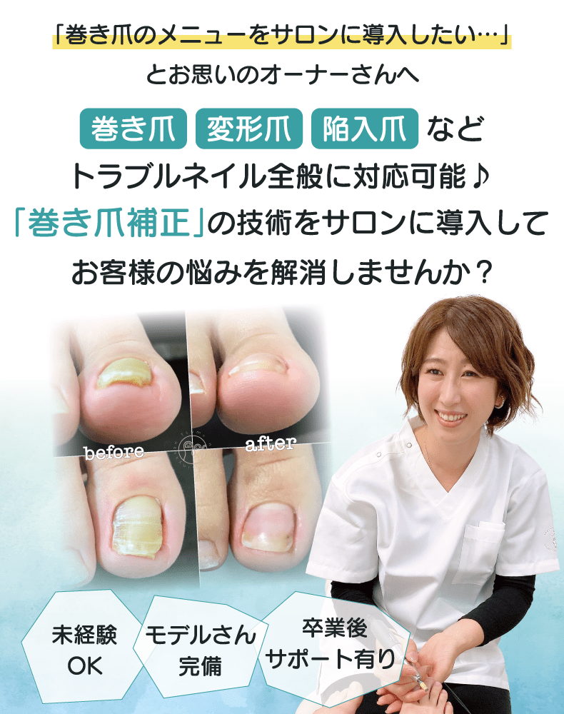 東京巻き爪補正スクール|巻き爪・変形爪・陥入爪の補正施術が学べる!クロミネイルズ